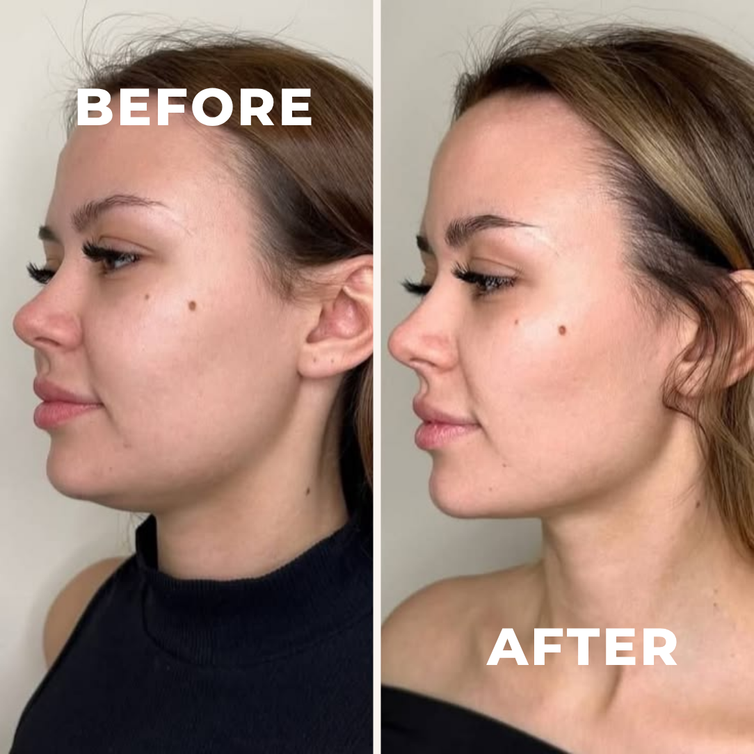 Organic Lymphatic Support Herbal Blend