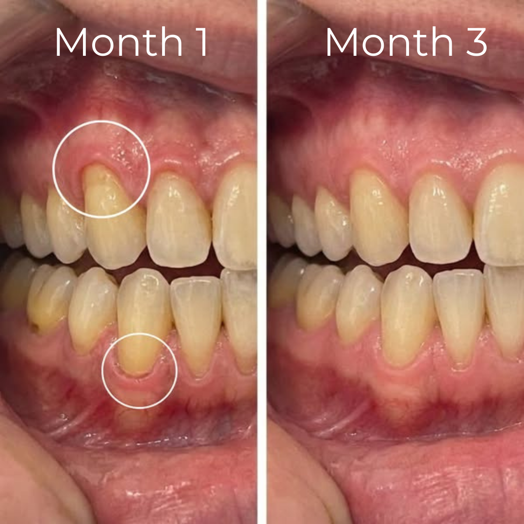 CollaGum Collagen Powder