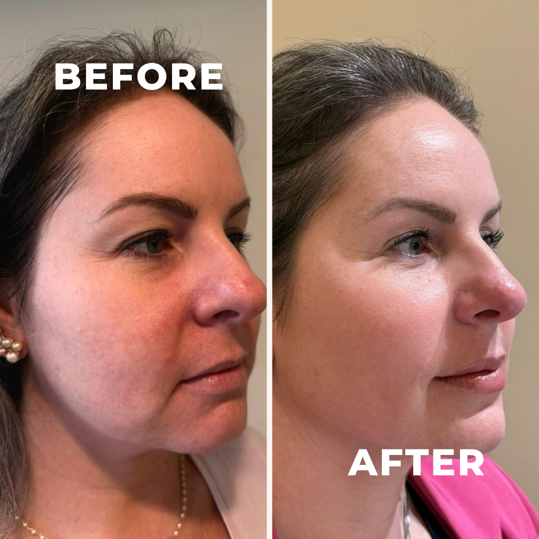 Perimenopause Fluid Support