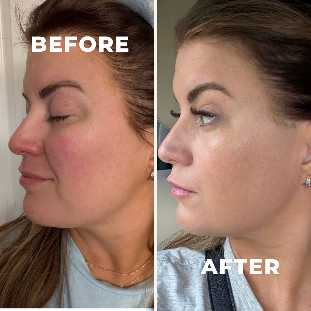 Perimenopause Fluid Support