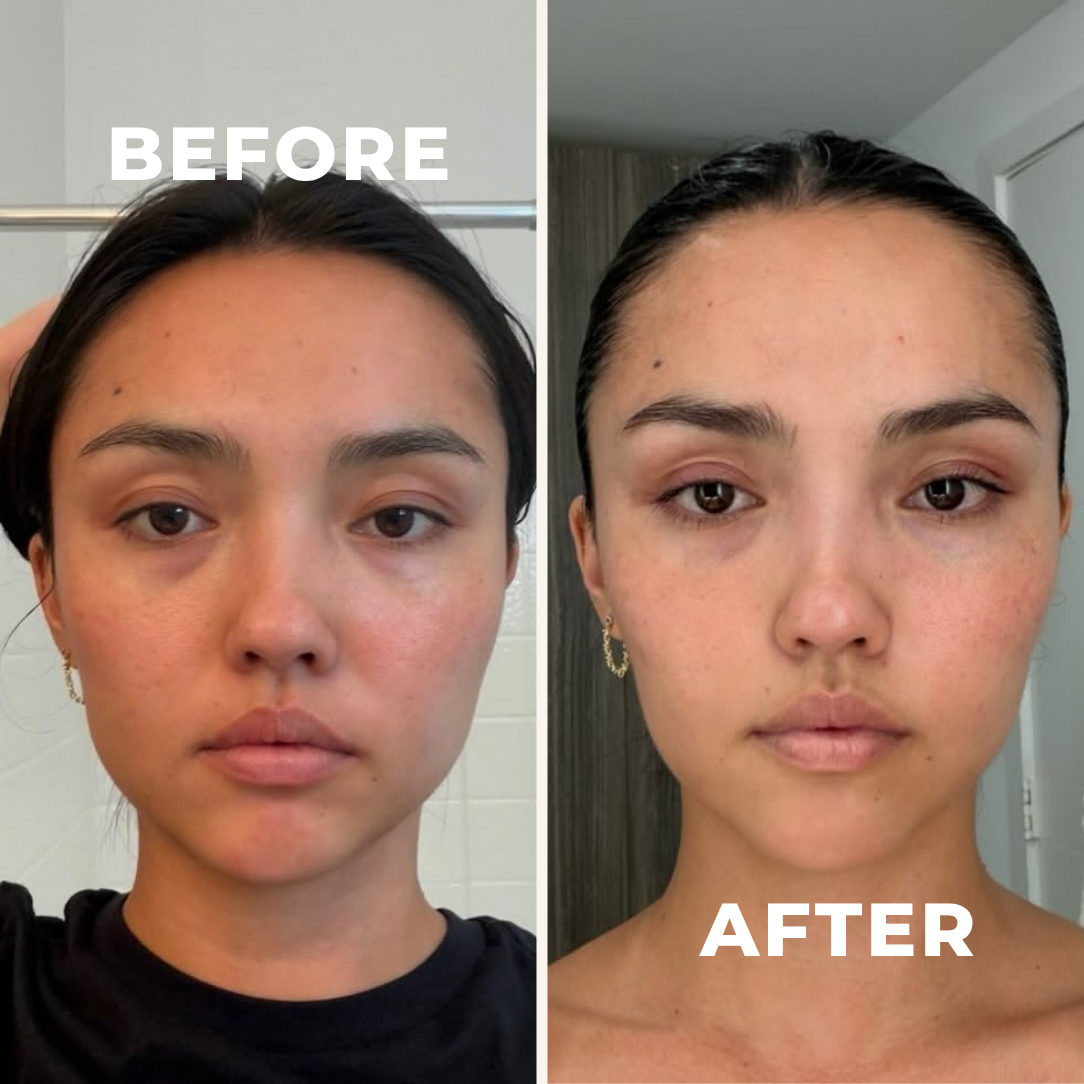 Organic Lymphatic Support Herbal Blend